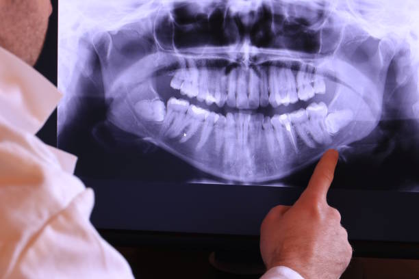 Best Weekend Emergency Dentist in Goose Creek, SC