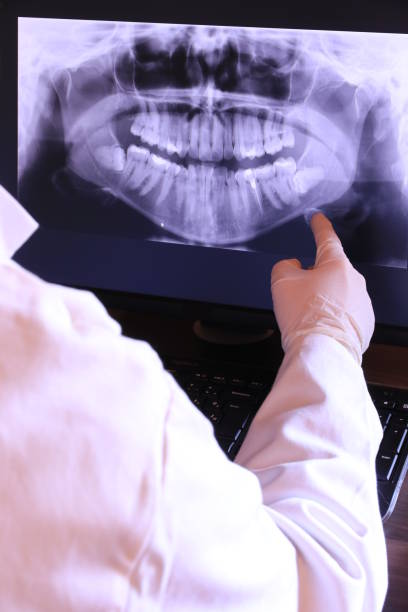 Best Emergency Treatment for Toothache in Goose Creek, SC